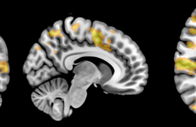 Using research virtual machines to analyse fMRI datasets