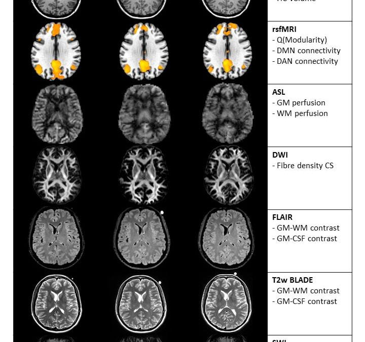 Travelling Heads – Measuring Reproducibility and Repeatability of Magnetic Resonance Imaging in Dementia